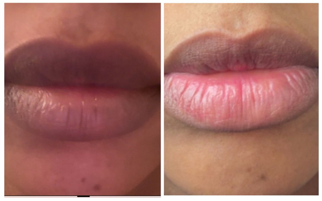 Lip Balm. Fast Transformation from DARK to PINK